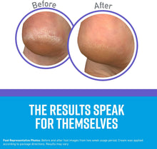 Load image into Gallery viewer, Healthy Feet Night Treatment Foot Cream